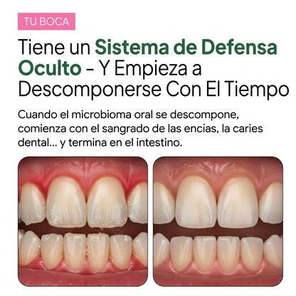 Probiótico Oral para el Mal Aliento